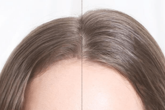 Prancha de Cabelo Profissional - Volume e Brilho Instantâneo